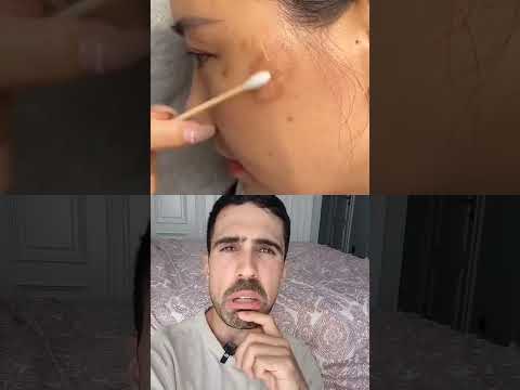 ELIMINAR MANCHAS de la CARA: DERMATÓLOGO te cuenta CÓMO despigmentar