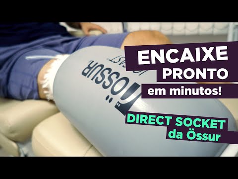 Encaixe em 40 minutos? Conheça o Direct Socket da Össur.
