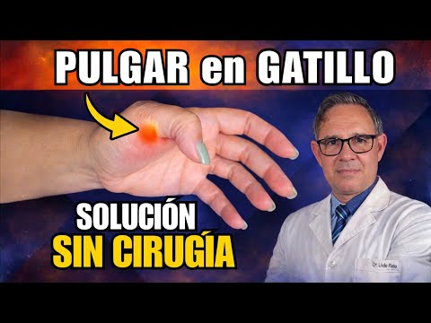 PULGAR en GATILLO o resorte - TRATAMIENTOS más EFECTIVOS  en 2026