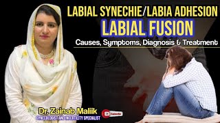 Download lagu What is Labial synechie | Symptoms and Solution of labia adhesion | labial fusion kia he? mp3 Download lagu What is Labial synechie | Symptoms and Solution of labia adhesion | labial fusion kia he? mp3