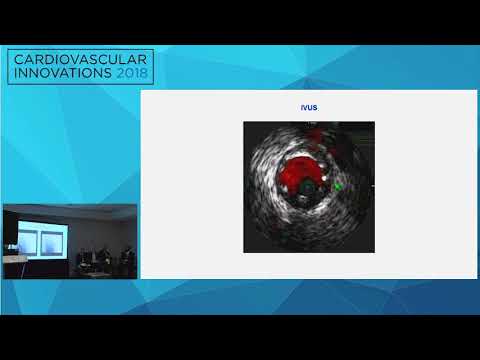 CVI2018 Session: Ad-hoc left main PCI - Michael S. Megaly, MD, MS