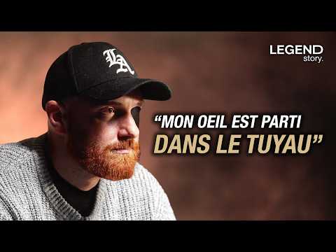 SON OEIL A ÉTÉ BROYÉ ET ASPIRÉ DANS UNE MACHINE PAR ERREUR À L'HÔPITAL, IL SE RÉVEILLE AVEC UN TROU