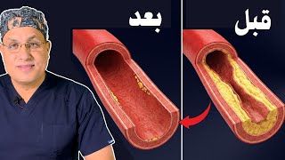 أفضل وجبة تفتح الشرايين وتحميك من الجلطات | كلام علمي بالأدلة