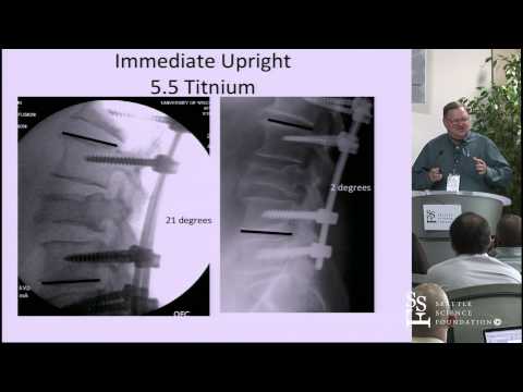 Spinal Instrumentation: Basic Concepts & Biomechanics by Paul Anderson, M.D.