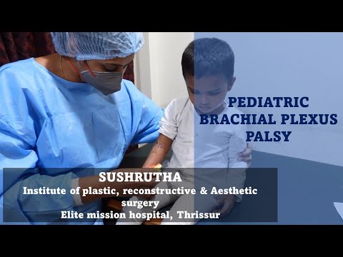Pediatric brachial plexus treatment at sushrutha plastic surgery department, elite hospital Thrissur