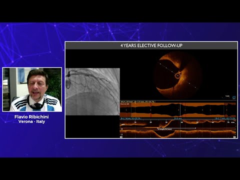 DCB, what you expect to see at follow-up from a “different” approach to PCI - Webinar