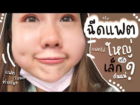เมโสแฟต ยี่ห้อไหนดี