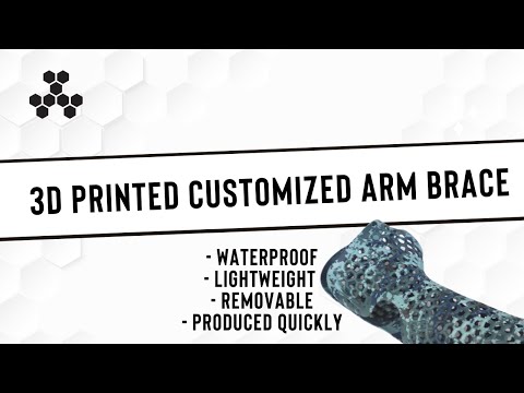 3D Printed Customized Arm Brace