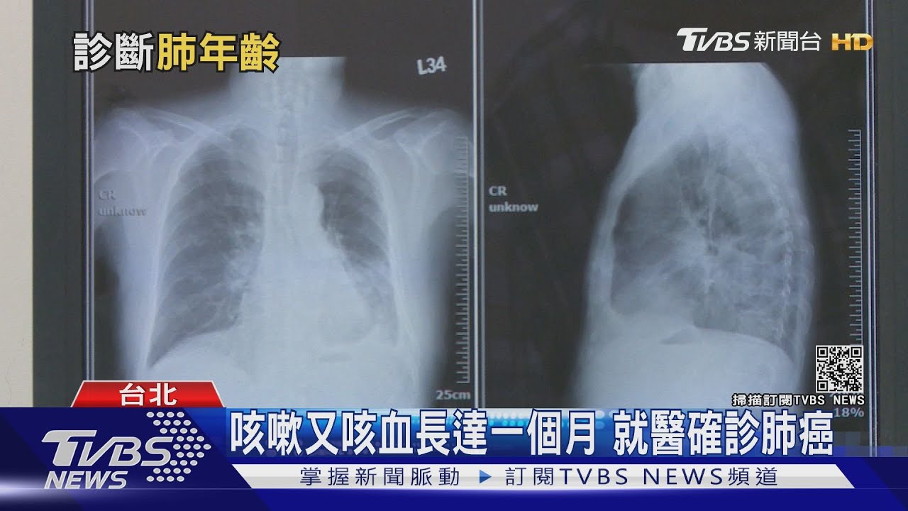 爬樓梯出現「這狀況」又不知覺吸入「它」 醫警告:肺疾病找上門!