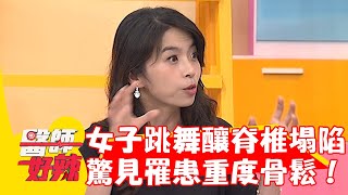 40歲女跳舞釀脊椎塌陷！就醫驚見罹患重度骨質疏鬆！【#醫師好辣】20230930 EP1570 part3