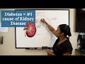 Diabetes is the Number 1 cause of Chronic Kidney Disease [Diabetic Kidney Disease] - CKD series #2