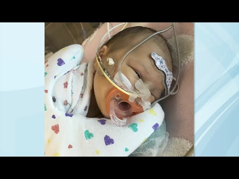 Fetal Echo Helps Discover Julianna's Transposition of the Great Arteries