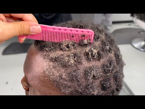 All This is coming out from his "CLEAN' scalp!!