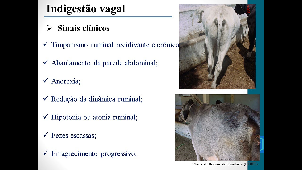 Indigestão vagal #aula 11