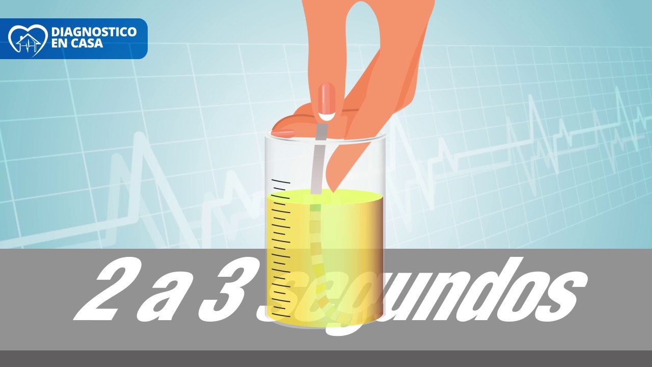 Analisis de orina con tiras reactivas de 10 parametros para detectar posibles enfermedades