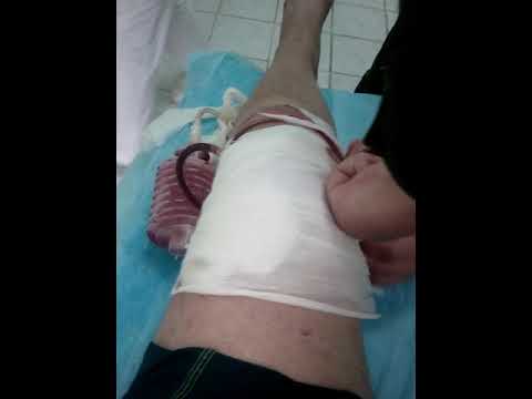 Повреждение заднего рога латерального мениска правого коленного сустава Удаление межпозвонковых грыж без операции