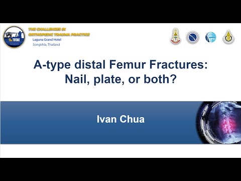 A-type distal Femur Fractures: Nail, plate, or both? Dr.Ivan Chua