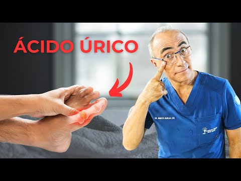 Ácido Úrico: Guía Completa para evitar La Gota
