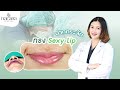 เพิ่มความมั่นใจ ให้กับรูปปาก ด้วยทรง Sexy Lip ที่ นารดาคลินิก