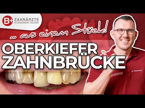 Zahnbrücke Vorher-Nachher - Echter Fall einer Patientin mit Versorgung des gesamten Oberkiefers!
