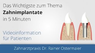 preview picture of video 'Implantat Passau - Zahnarzt Passau, Bad Griesbach Dr. Rainer Ostermaier'