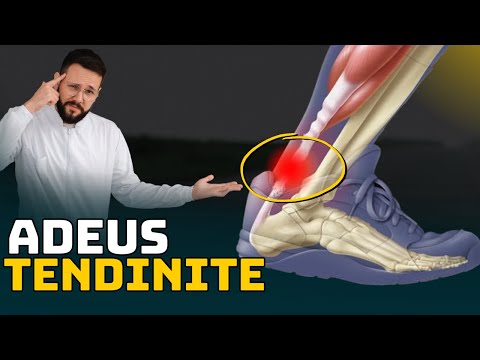 Best Exercises to Cure Achilles Tendinitis (Achilles Tendonitis)