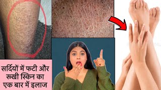 How to repair very Dry and Cracked Skin at Home with Natural Home Remedy