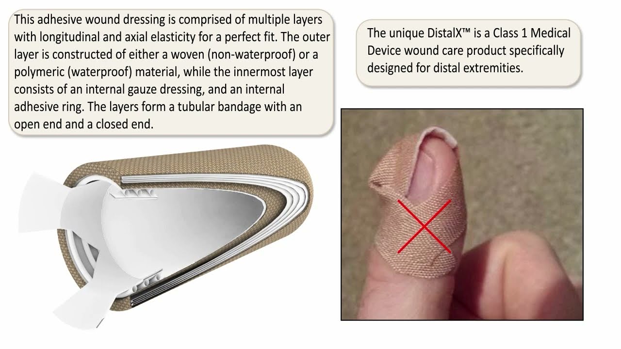 Introducing DistalX : The neXt generation of Wound Care for Fingers and Toes
