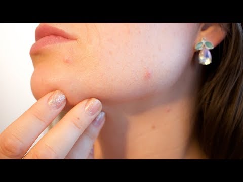 Faccia che si solleva dopo di 45 anni Le rassegne di faccia fresca affrontano pacchi