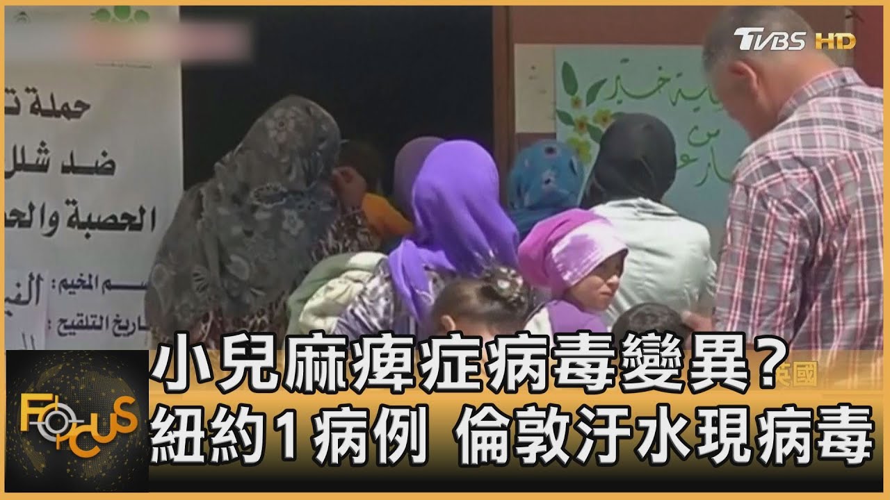 小兒麻痺症病毒變異？紐約1病例　倫敦汙水現病毒