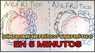 Síndrome Nefrítico y Nefrótico EN 5 MINUTOS !!