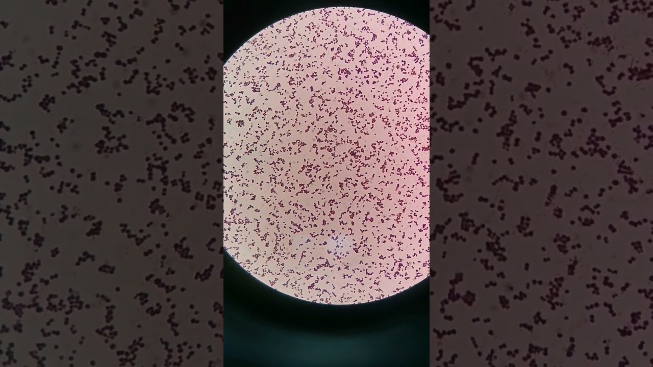 Staphylococcus under the microscope #laboratory #medtechstudent #mls #cls #bacteria #gramstaining