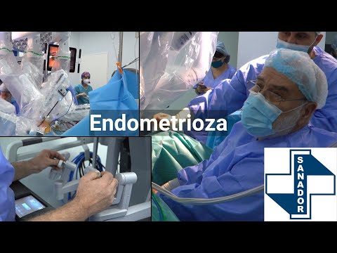 Endometrioza – Dr. Bogdan Marțian | Spitalul Clinic SANADOR