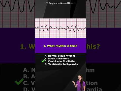 ECG Rhythm Pop Quiz: Can You Identify These EKG Rhythms? #shorts