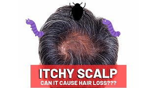 Itchy Scalp and Hair Loss (5 Big Causes!)