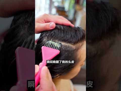 Zingiber Biotin Therapy Walkthrough - 解决头发稀疏问题