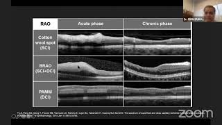 Download Lagu AIOS ARC Enhancing Concepts OCT u0026 OCT... Dr RISHI PUKHRAJ Thumbnail