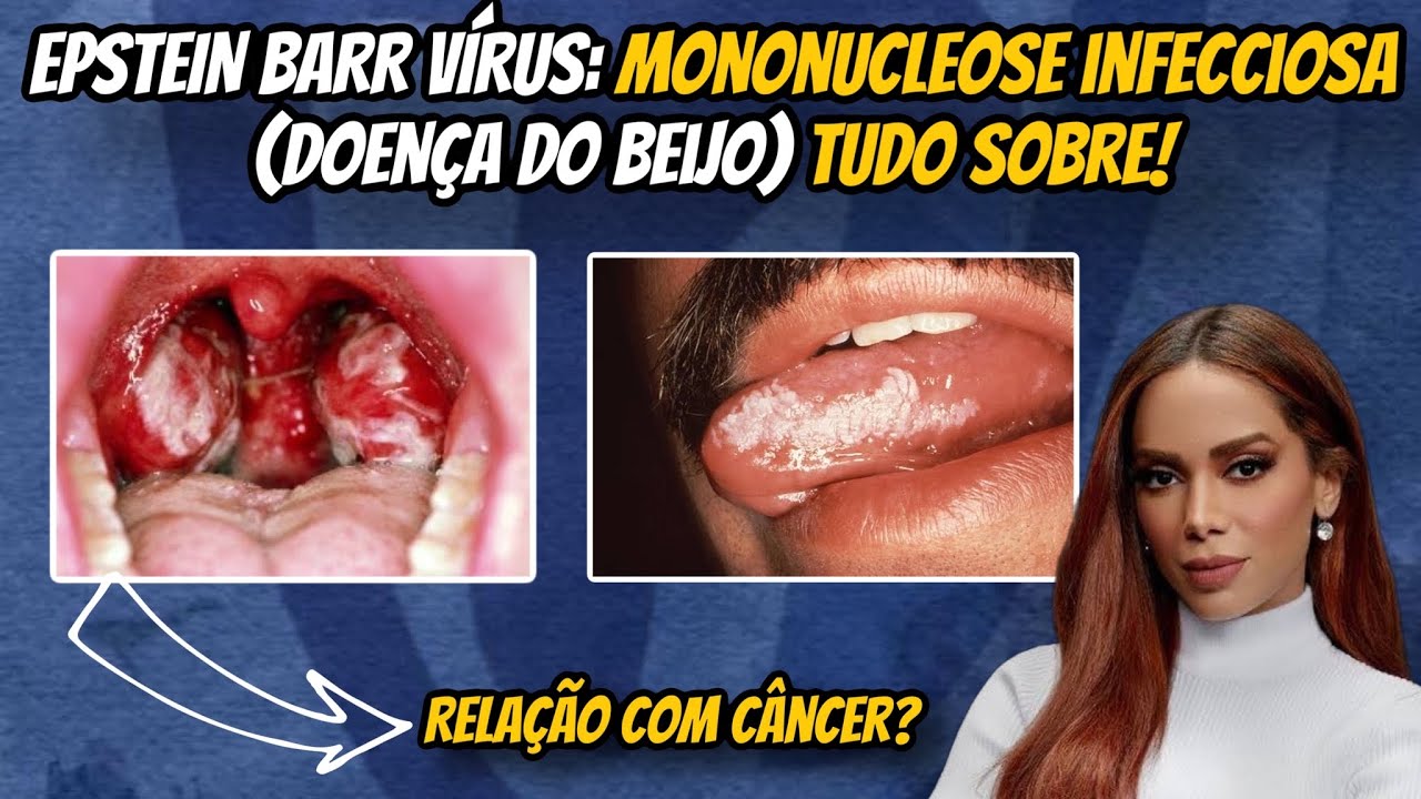 Francisco De Assis Almeida Lima Júnior-37