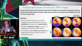 AICONM24 - TEP ou TEMP cardiaque pour l'imagerie de la perfusion myocardique (PY MARIE)