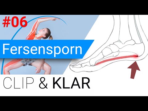 Fersensporn erklärt - chronisch entzündete Fusssohlen-Sehnenplatte