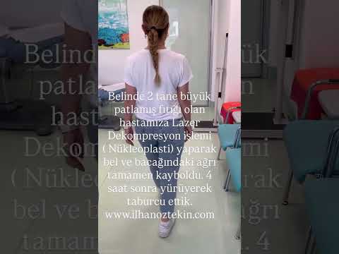 Bel fıtığı İçin Lazer Dekompresyon (Nükleoplasti) İşlemi