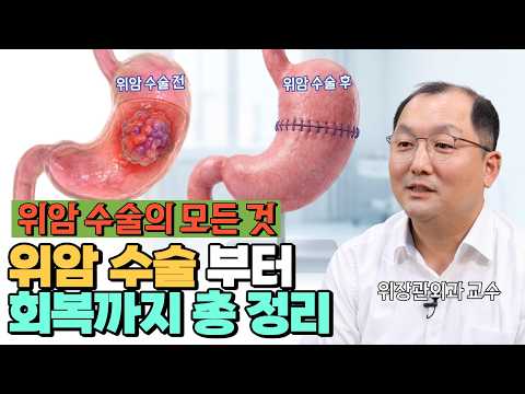 영상 썸네일