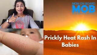 Prickly Heat Rash In Babies | How To Prevent And Home Remedies.