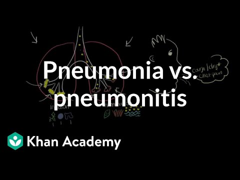 Pneumonia Vs Pneumonitis Video Khan Academy