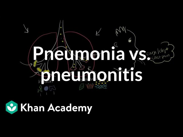 Pronunție video a pneumonitis în Engleză