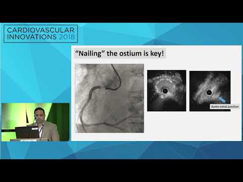 CVI2018 Session: Innovation in coronary ostial lesion management - Anand Prasad, MD