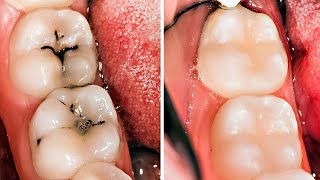 Toothache - Effective Home Remedy For Toothache | Dr. Vivek Joshi