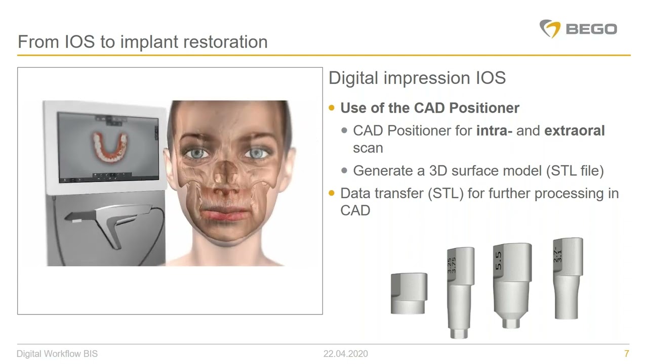 BEGO Implant Systems – CAD/CAM: individual prosthetics with 3Shape and Exocad