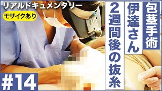 【包茎手術】手術後2週間後のリアルをお見せします！（伊達さん）