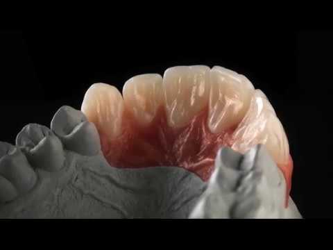 Ceramill Zolid FX Mulitlayer – L'estetica non è statica